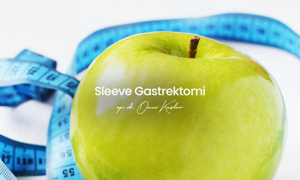 Sleeve Gastrektomi (Tüp Mide Ameliyatı)