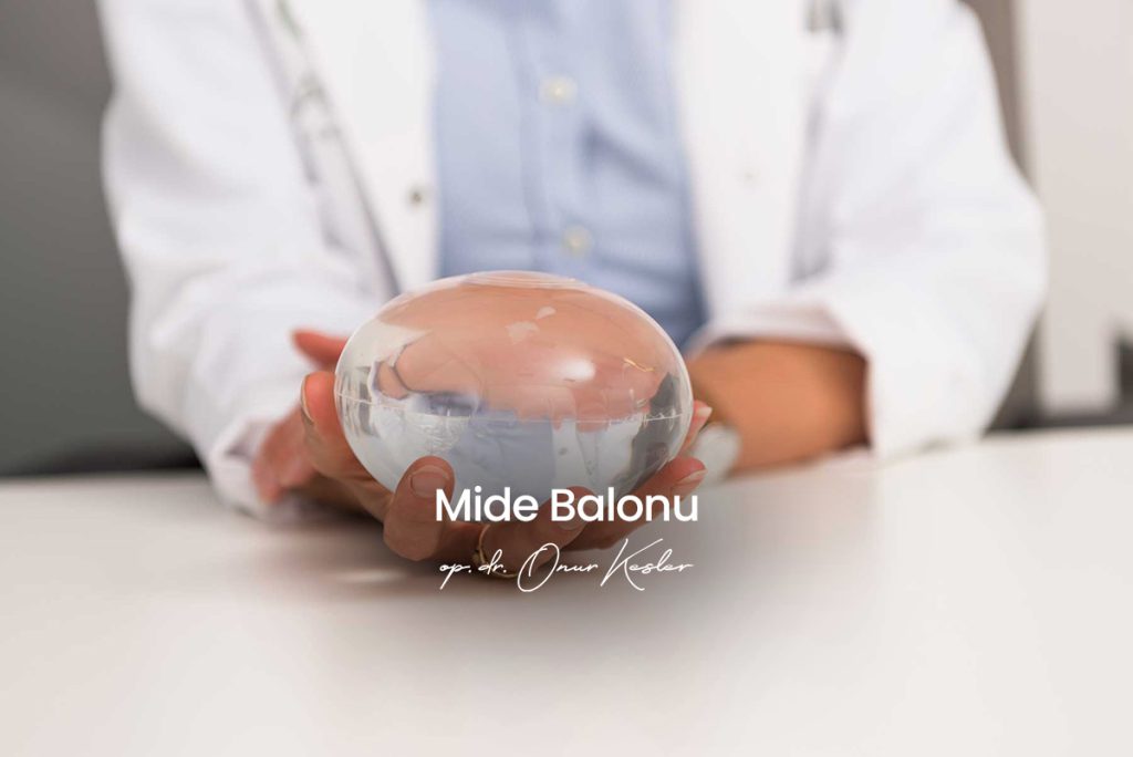 Mide Balonu